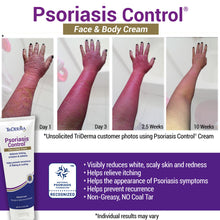 Load image into Gallery viewer, Psoriasis Control® Cream