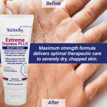 Load image into Gallery viewer, Extreme Dryness PLUS™