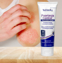 Load image into Gallery viewer, Psoriasis Control® Cream