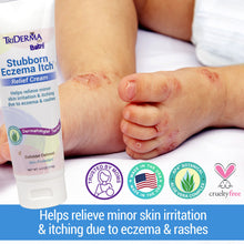 Load image into Gallery viewer, Stubborn Eczema Itch™  Relief Cream
