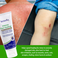 Load image into Gallery viewer, Intense Fast Healing® Cream
