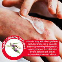 Load image into Gallery viewer, Eczema Fast Healing™ Cream
