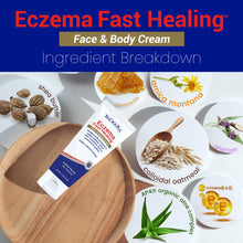 Load image into Gallery viewer, Eczema Fast Healing™ Cream
